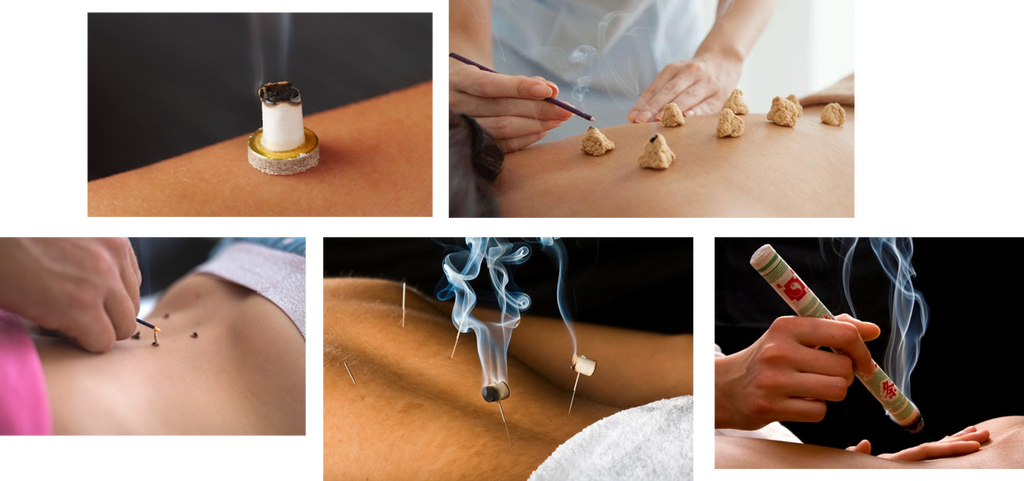Moxibustion and What You Should Know